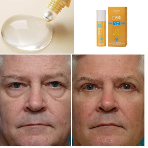 Rolon 5 em 1 Ultra Rejuvenescedor Luteína Inova® PAGUE 1 LEVE 3 (com entrega relâmpago ⚡)